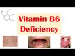Відео огляд на Vitamin B-6 200 mg, Вітамін B-6 200 мг, 90 капсул