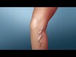 Відео огляд на Future Biotics, VeinFactors, Підтримка вен ніг, 180 капсул